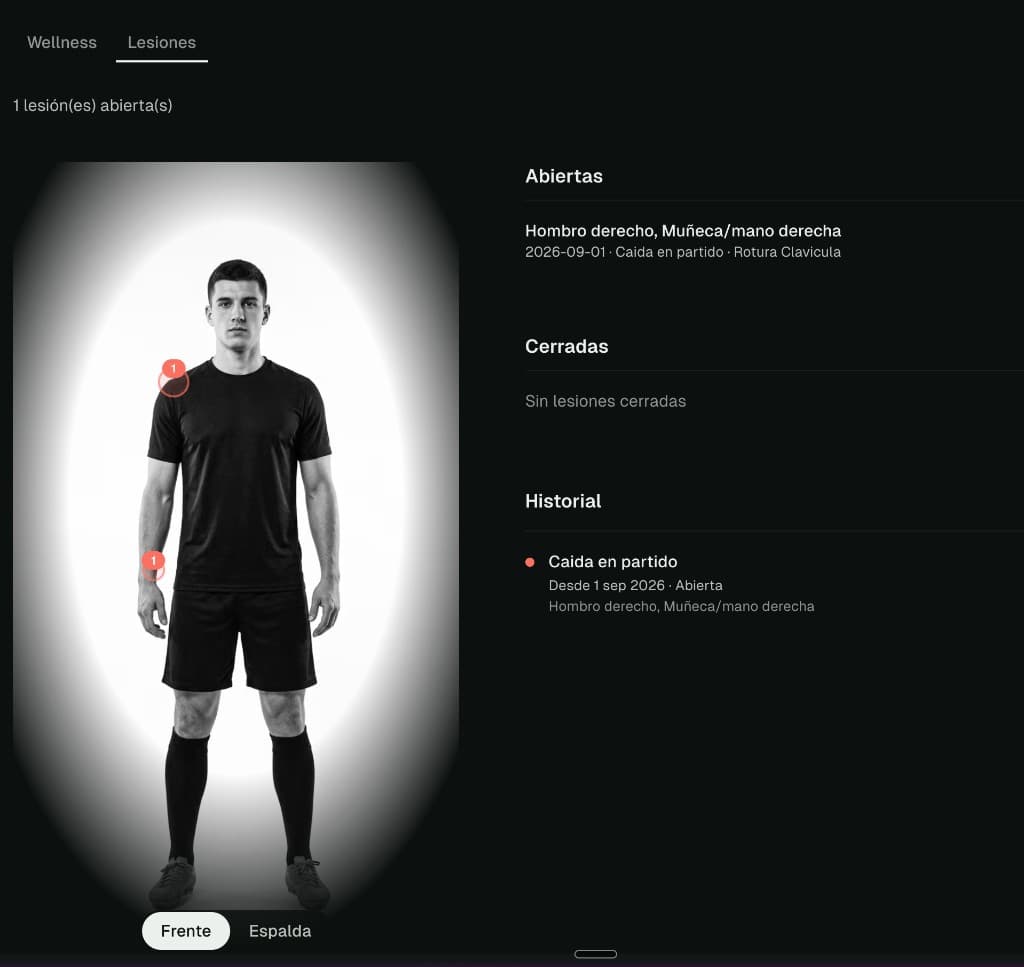 Staff injuries view with a player figure, numbered body markers, and open closed history lists